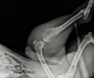 radiografia osteosarcoma nel cane